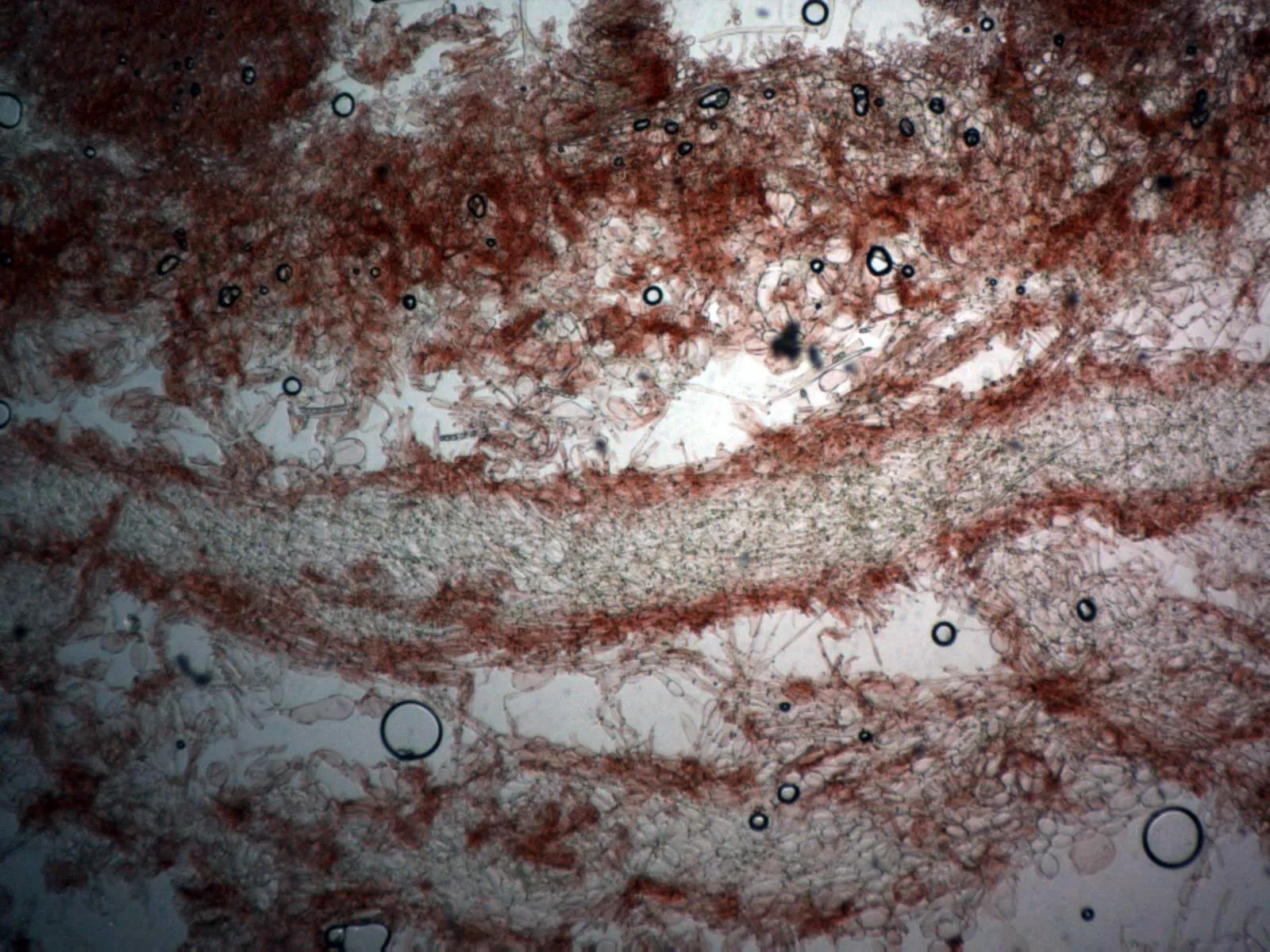Microscopía de Peziza varia - 14 - Sección x 40 con compacta capa de hifas longitudinales